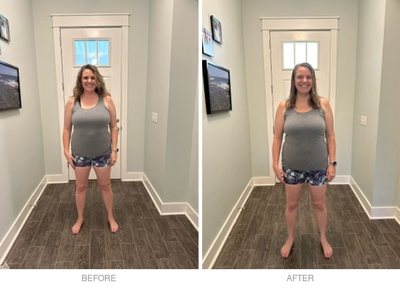 Jessica before and after